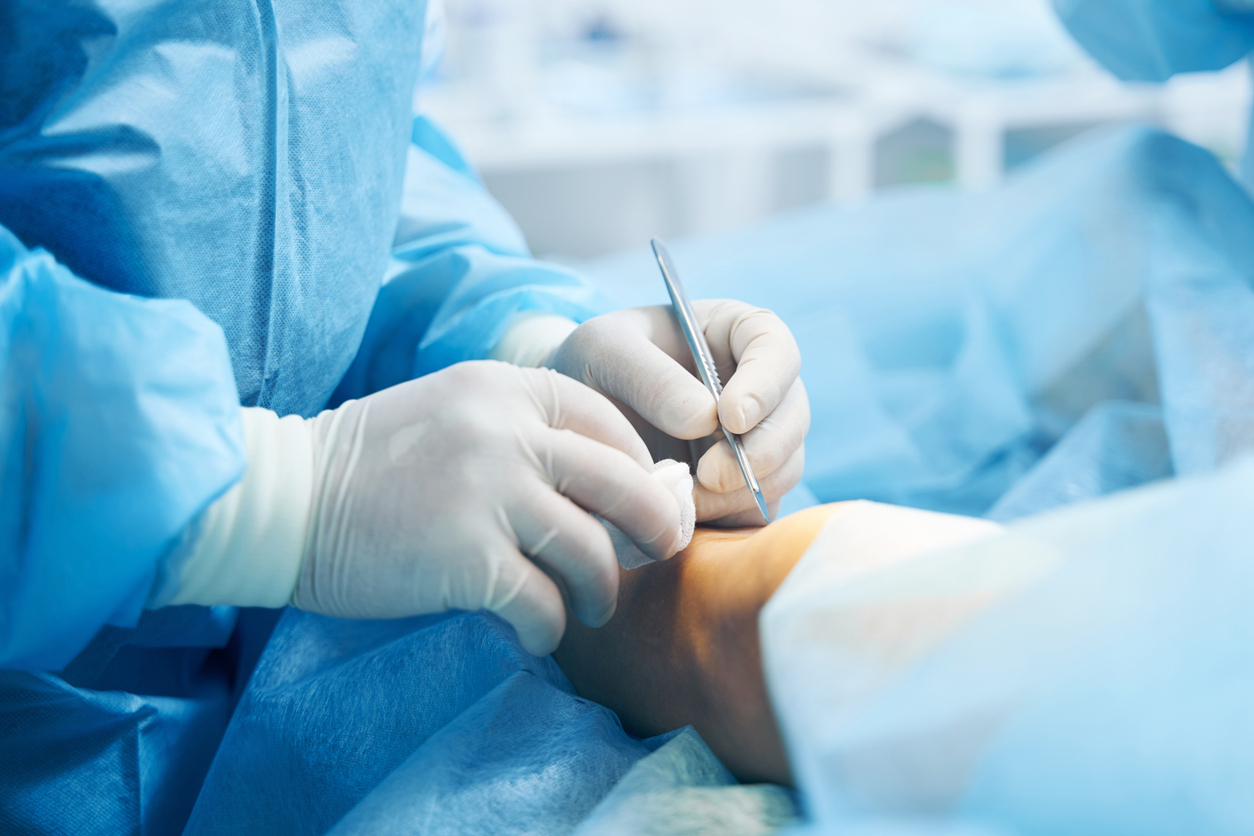 Surgical Options