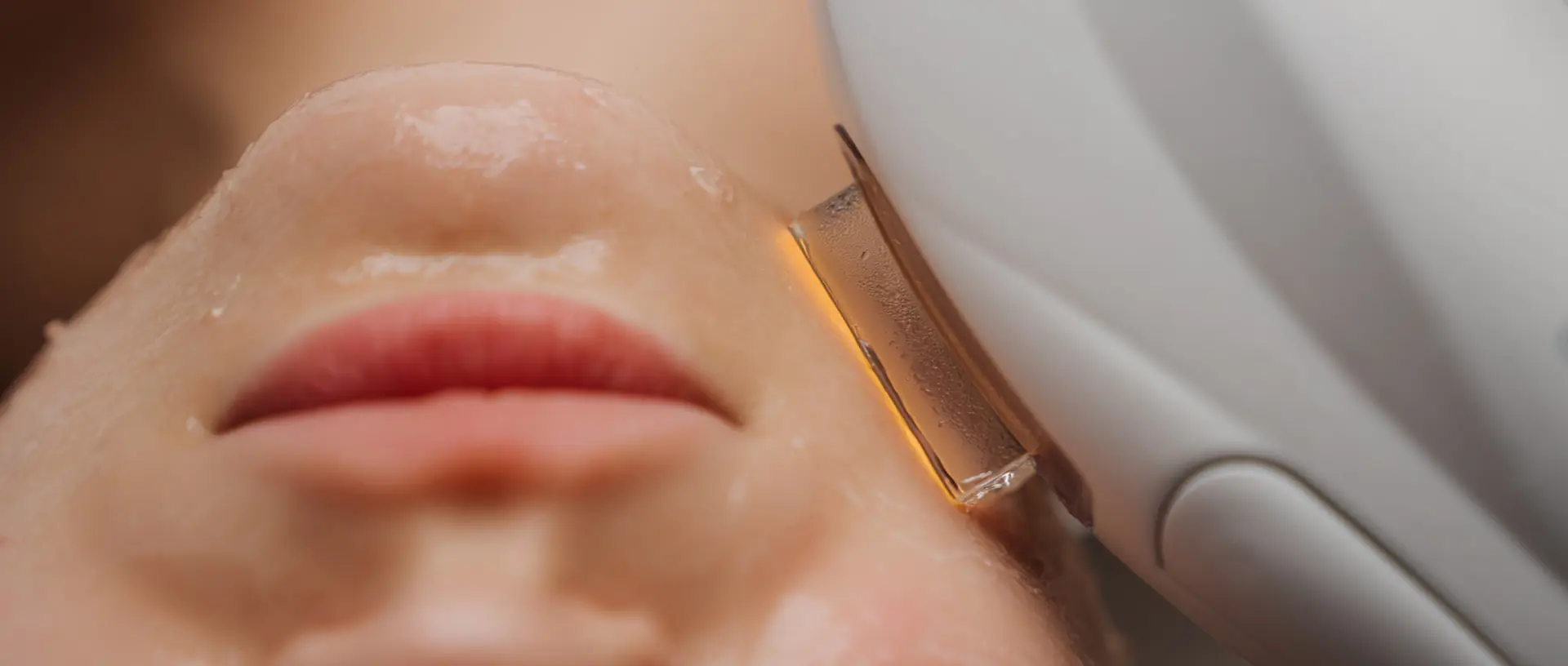Laser for Facial Veins
